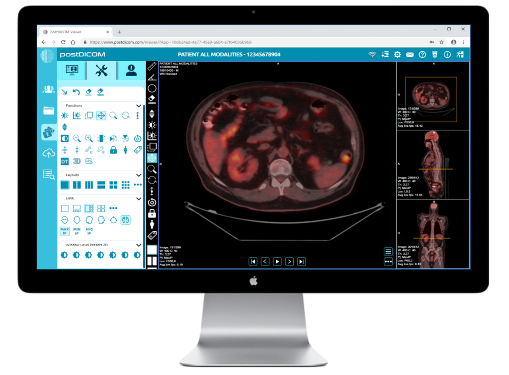 free DICOM viewer on Mac